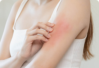 반복되는 심한 가려움 참고 사진