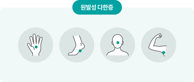 원발성 다한증에서 흔히 확인하는 손·발·얼굴·겨드랑이 분포